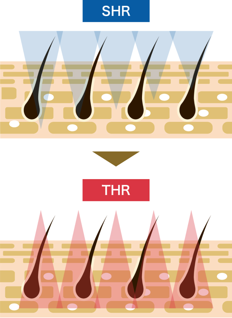 SHRとTHRの図